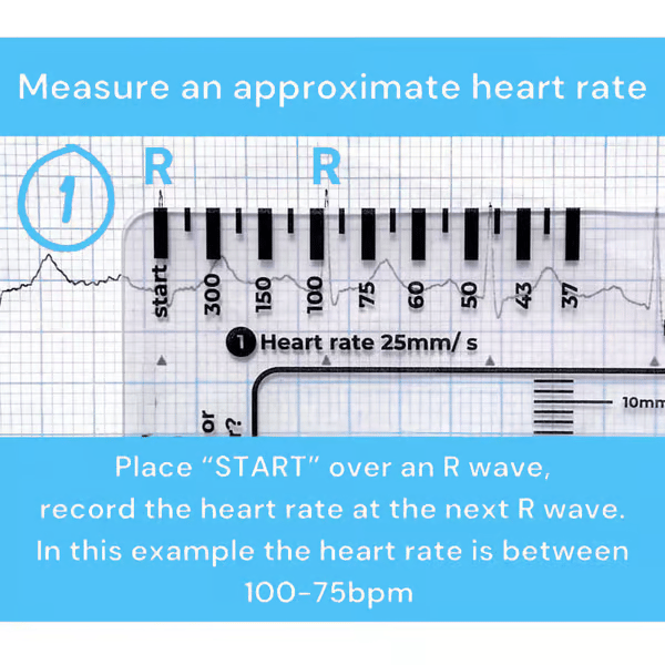 (🔥HOT SALE NOW 60% OFF) -ECG 7 Step Ruler