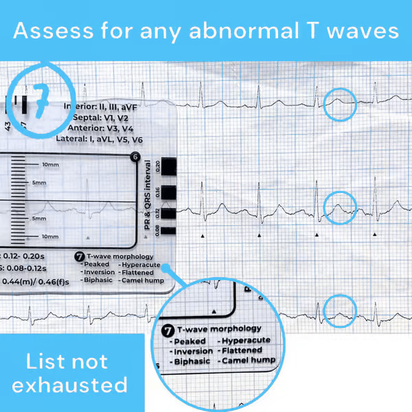 (🔥HOT SALE NOW 60% OFF) -ECG 7 Step Ruler