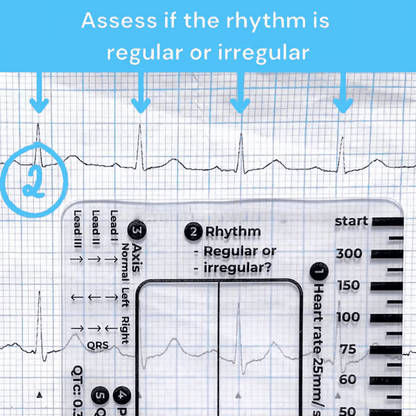 (🔥HOT SALE NOW 60% OFF) -ECG 7 Step Ruler