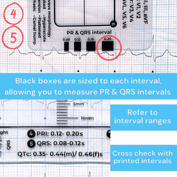 (🔥HOT SALE NOW 60% OFF) -ECG 7 Step Ruler