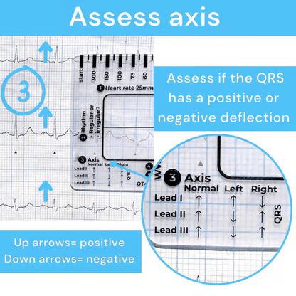 (🔥HOT SALE NOW 60% OFF) -ECG 7 Step Ruler